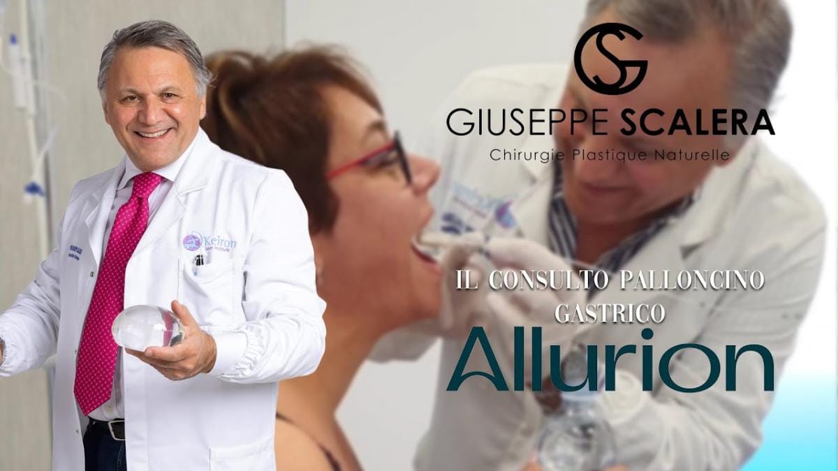 Palloncino Gastrico allurion Avellino