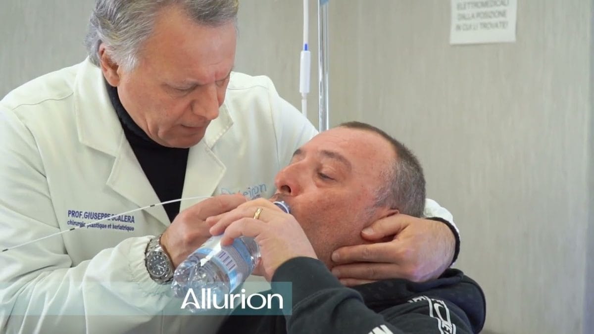 Palloncino Gastrico Allurion Salerno