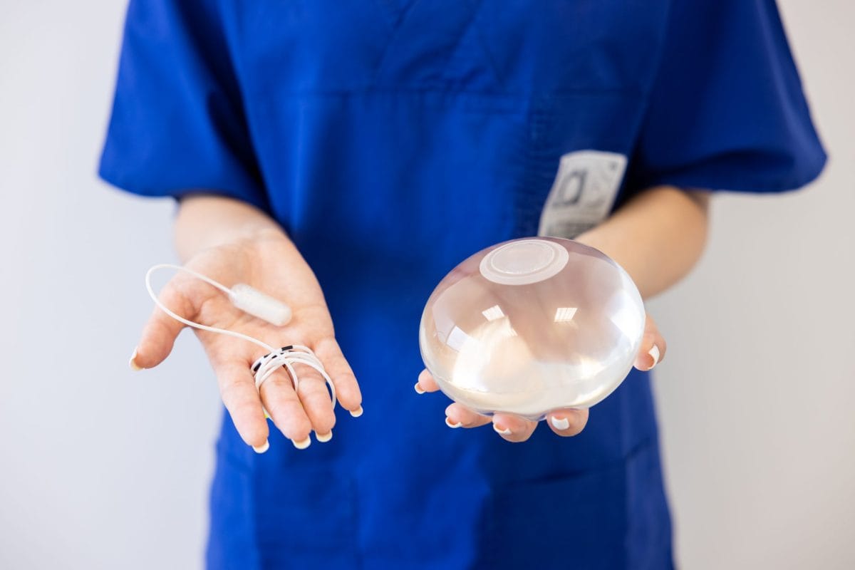 Palloncino-Gastrico-allurion-Napoli